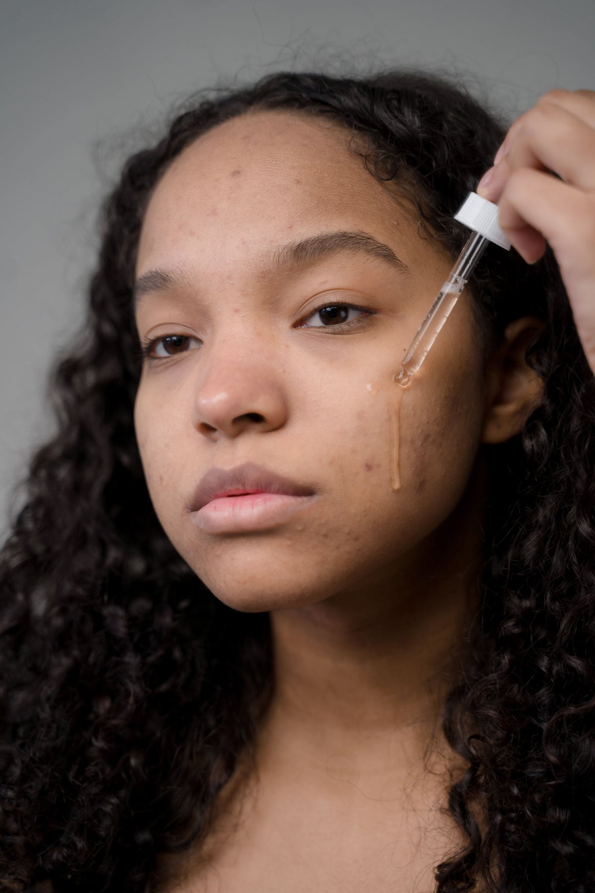 Acne - skin Ritual
