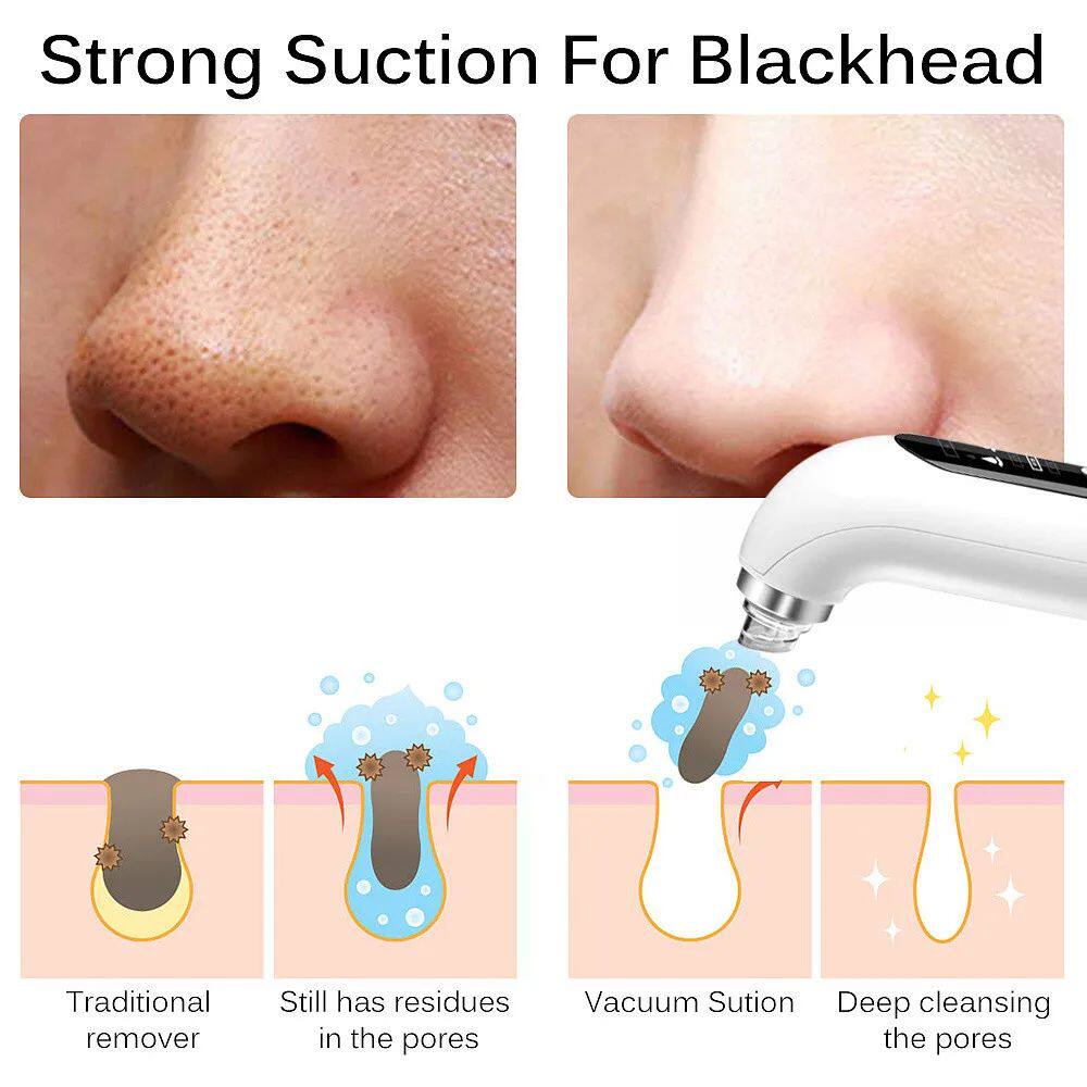 Electric Facial Pore Cleanser - skin Ritual