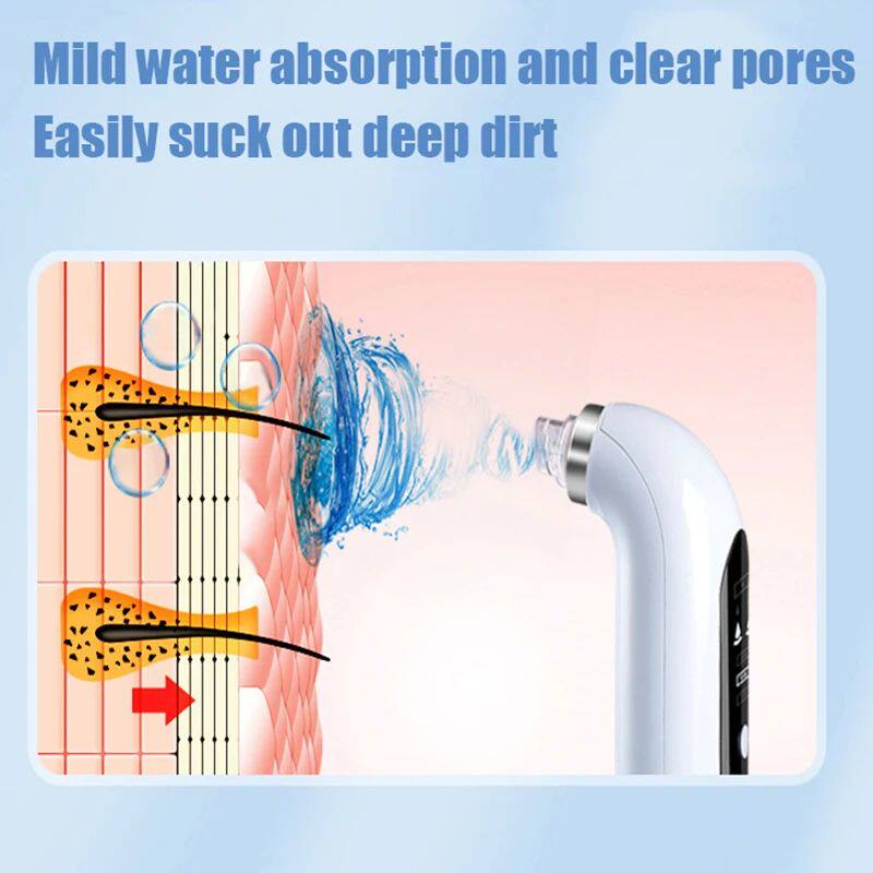 Electric Facial Pore Cleanser - skin Ritual